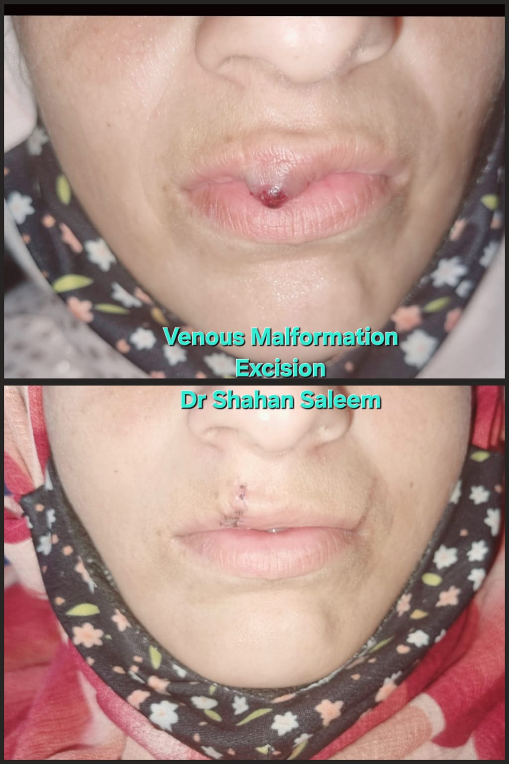 Before & After 47